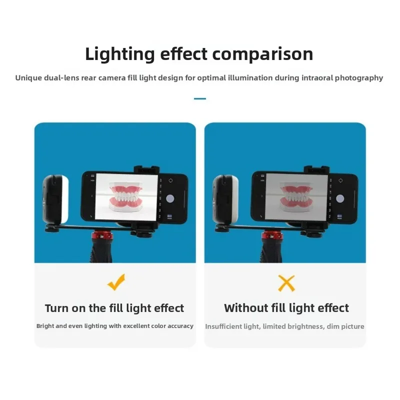 ضوء تصوير الأسنان، فلاش LED بل - مراجعة Lighting Gallery وسعره